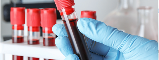 Comprehensive Blood Testing