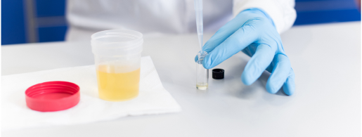 Urine and Electrolyte Testing