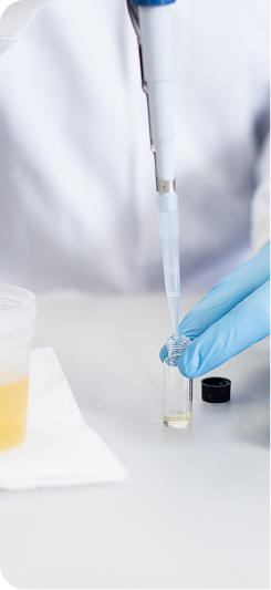 Urine and Electrolyte Testing